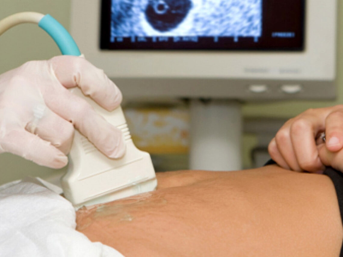 Criteria for ultrasound diagnosis of malignant tumors