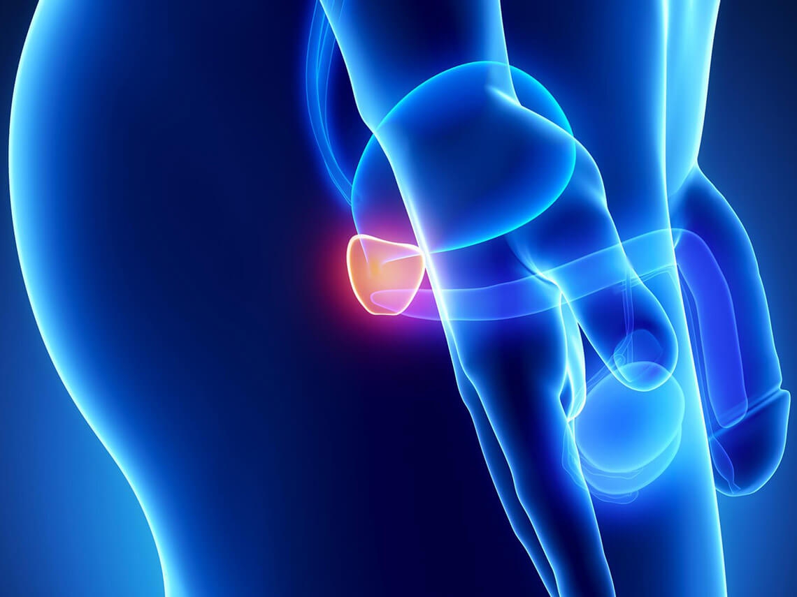 lod therapy prostatitis